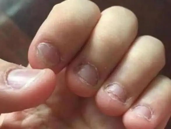 喜欢"咬手指"的宝宝,长大后怎么样了?专家:逃不掉2种结局