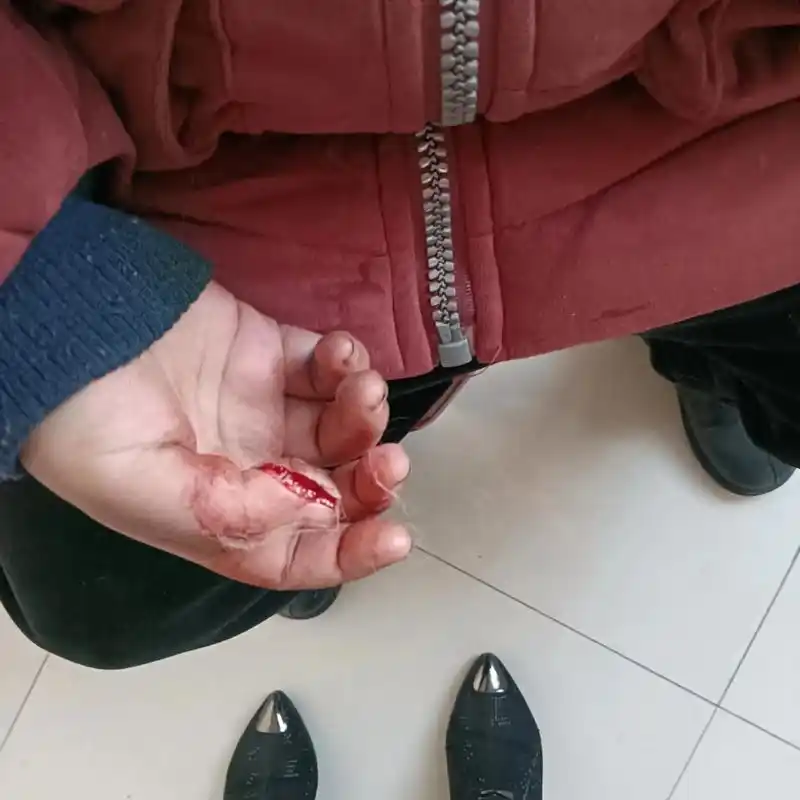 昨天买个小刀削铅笔.把手削了翻过来/.到振 - 抖音