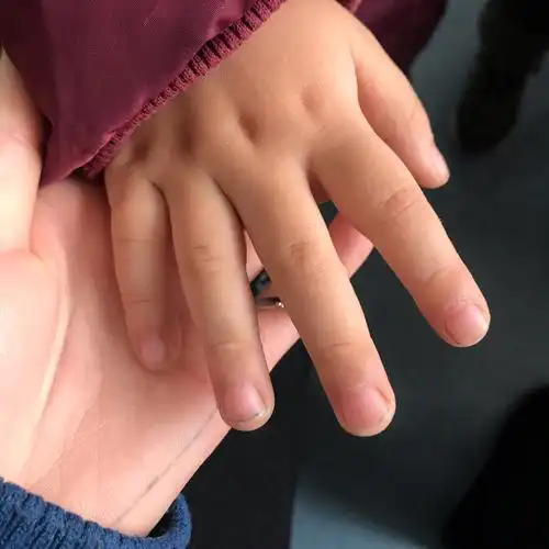 该剪指甲啦 指甲太长不卫生哦