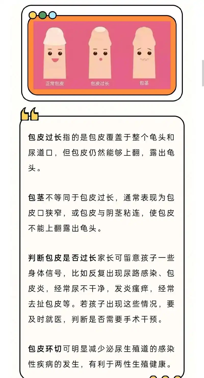 科普包皮手术时机及手术方式 - 抖音
