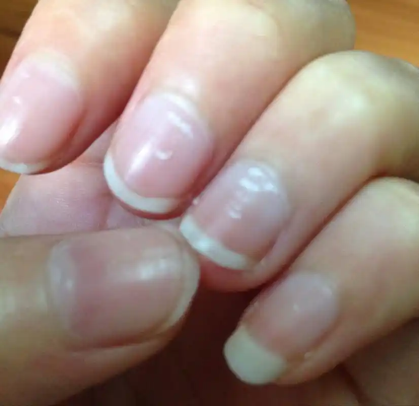 指甲上面那个小白点是什么呢?会不会有什么问题?求解,谢谢