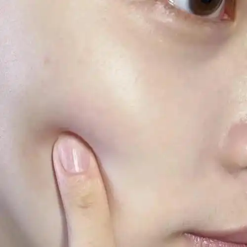 脸出油很厉害该怎么办