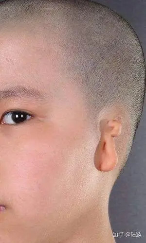 先天性右耳畸形,报考公务员能过体检吗?