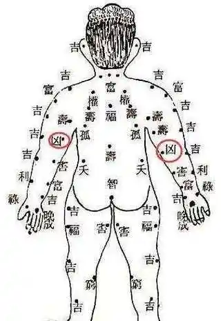 女人身上这几个位置的痣最"凶",破财克夫,一定要点掉!|163