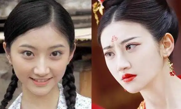 景甜整容前后的对比:整容失败的明星(4)