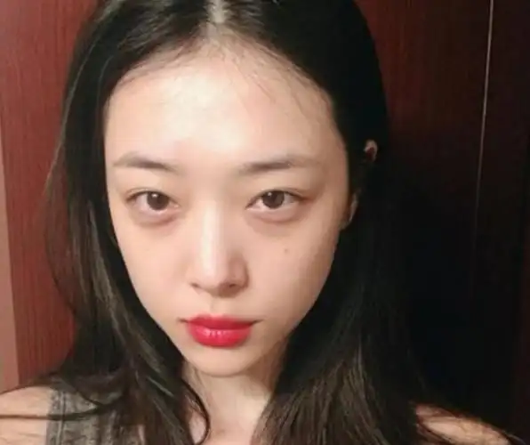 明星们都有的困扰,你注意到了吗?_黑眼圈