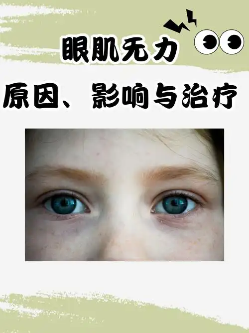 今天,我们就来聊聊眼肌无力的原因,影响以及治疗方法