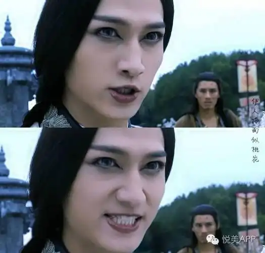 你是地包天都以为明星好当原来偷偷做了截骨术