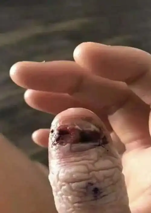 娃又把指甲啃秃了,没事就啃,怎么破?|鼻屎|牙齿|咬手指_网易订阅