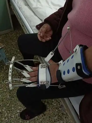 [南石医院假肢矫形科]早间分享