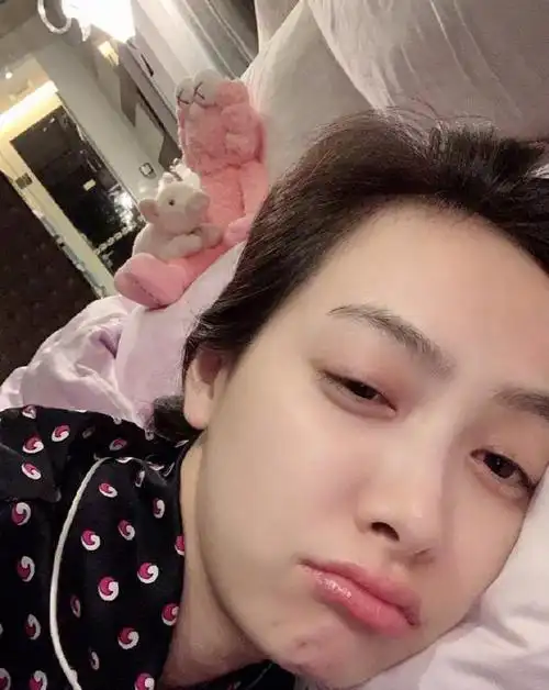 宋茜绿洲发文为吃而烦恼晒素颜躺床自拍皮肤水嫩