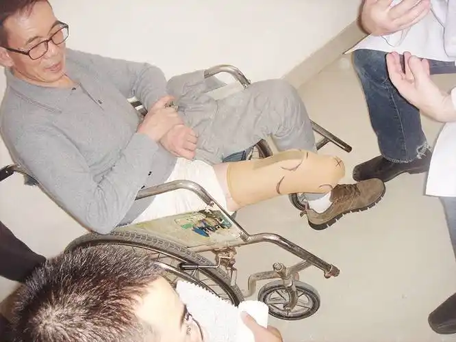 小腿假肢装配前一定要做的事_绷带_皮肤_弹性