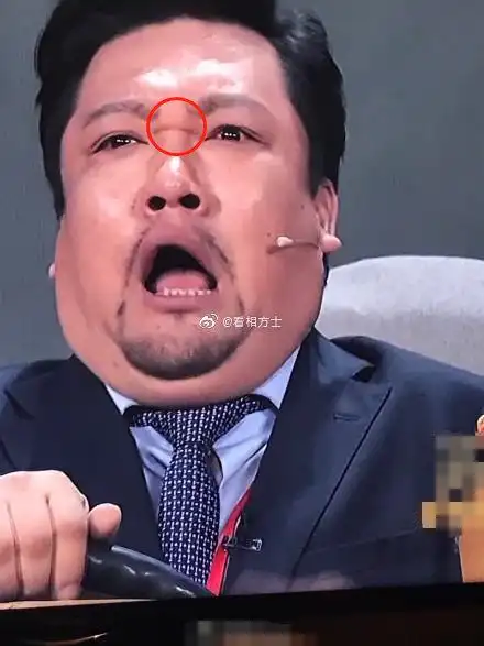 山根有横纹,易发生婚变!