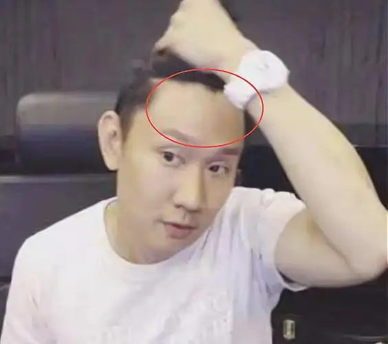 林俊杰终于鼓起勇气掀刘海,本以为不好看,看清后:帅哥你谁?