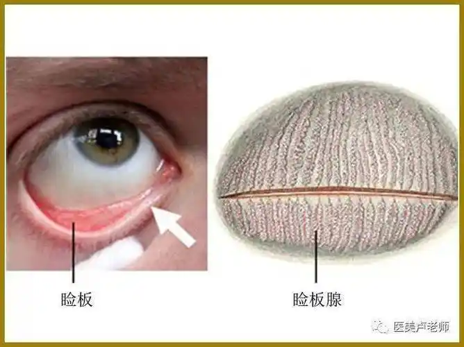 眼睑与眼睑的组织结构