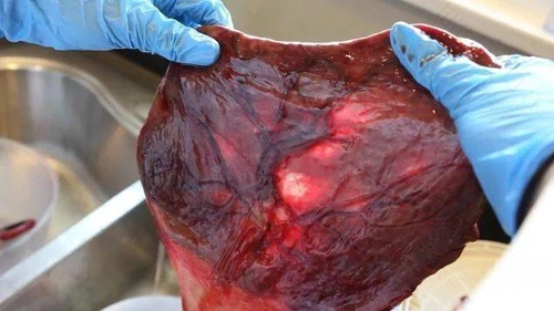 胎盘到底能不能吃胎盘到底能不能吃答案让人吃惊