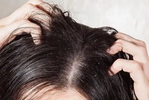 冬季头皮总是痒?位元堂中药草本系列养发护发轻松搞定 - 读我网 山东