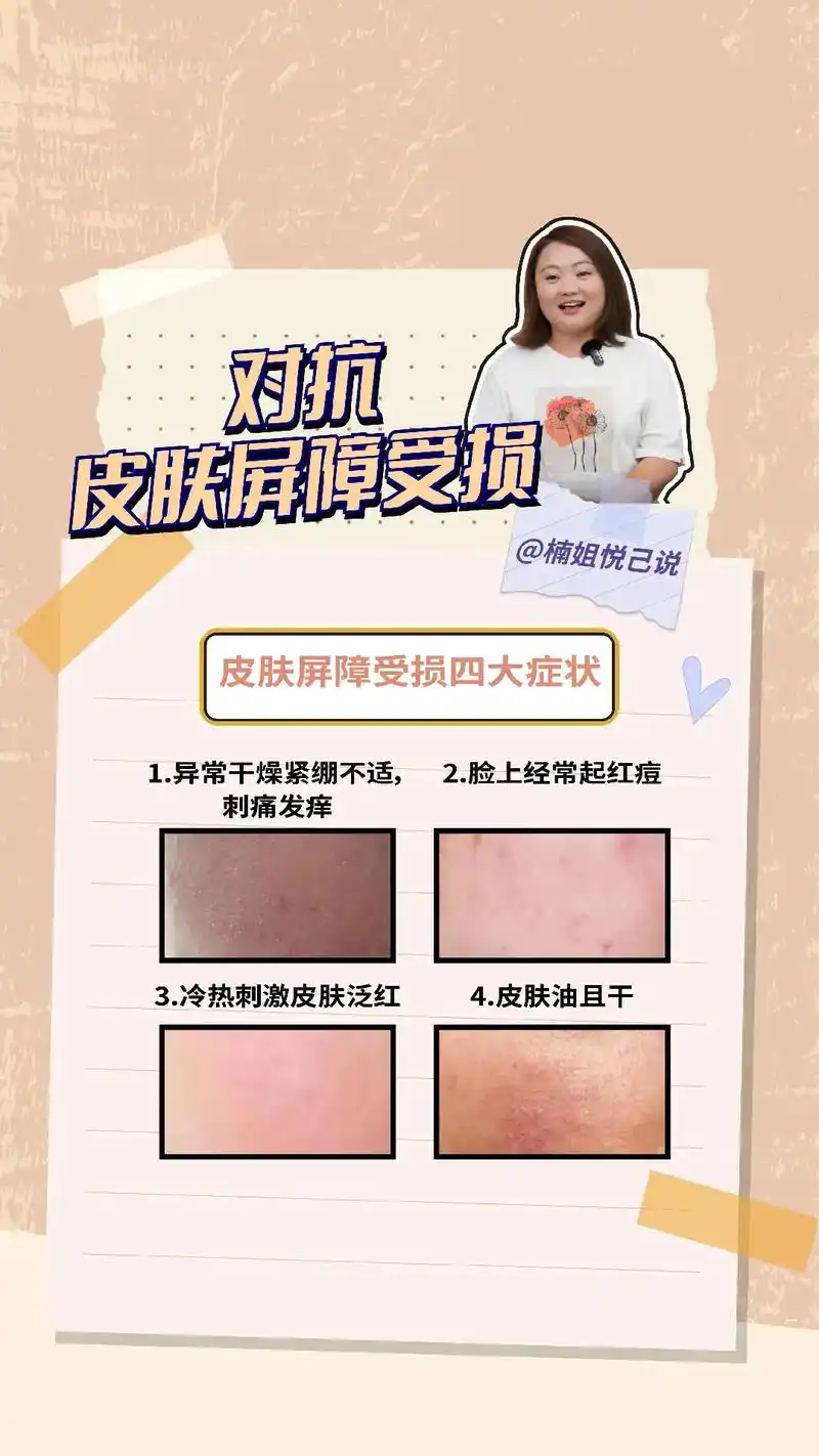 对抗皮肤屏障受损.#皮肤屏障受损   皮肤屏障受损四大症状你 - 抖音