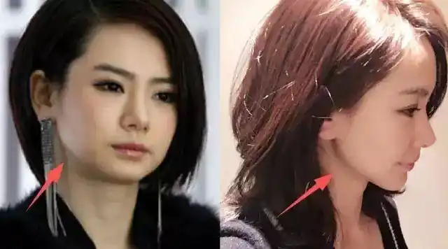 霸王花戚薇也整容了前后对比差异甚大