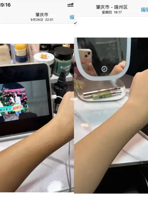 关于我坚持美白一个月这件事