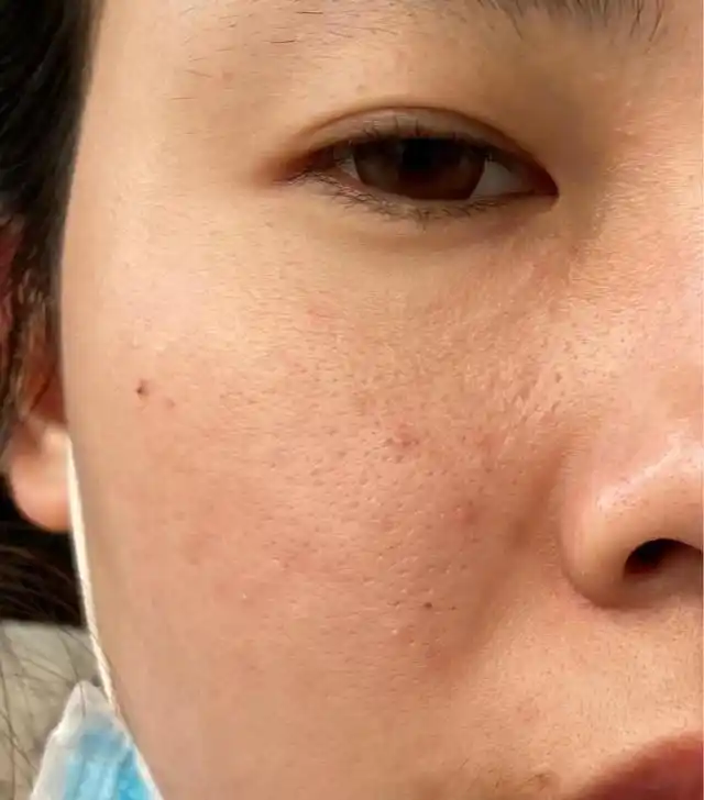 留意一下这几个脸部特征,可以预防脸部缺水!