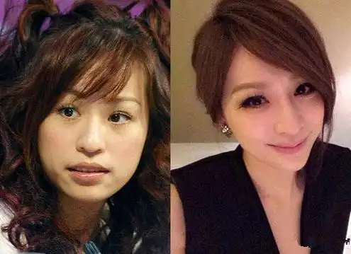 王心凌疑现整容后遗症 扮可爱脸上坑坑洼洼