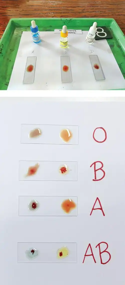 oab血型你听过吗献血是如何检测血型的