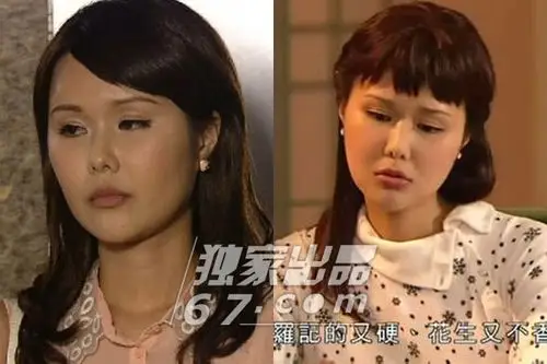 tvb陷面瘫危机:徐子珊似塑料脸 杨怡肌肉僵化下巴歪