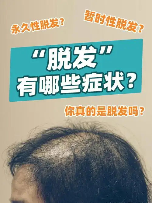 脱发有哪些症状