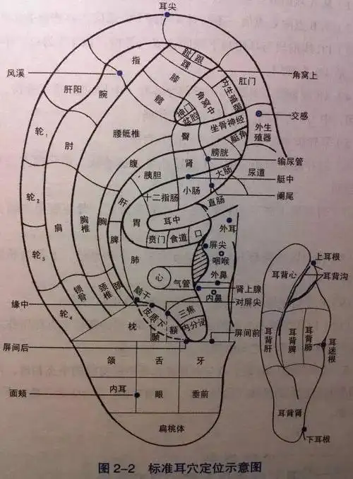 失眠咋办数绵羊out了快给耳朵压几颗豆豆