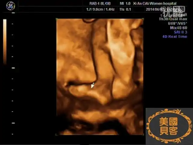 26周多小闺女四维彩超视频!-健康视频-搜狐视频