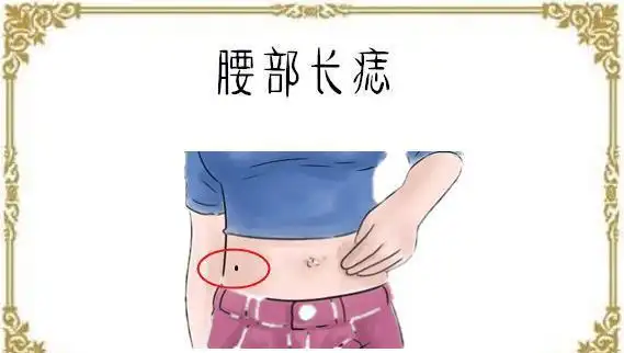 万两难买4颗痣个个腰缠万贯富可敌国难得一遇的好命