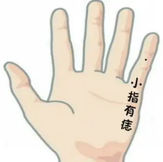 手指长痣的寓意,哪根手指长痣桃花多?