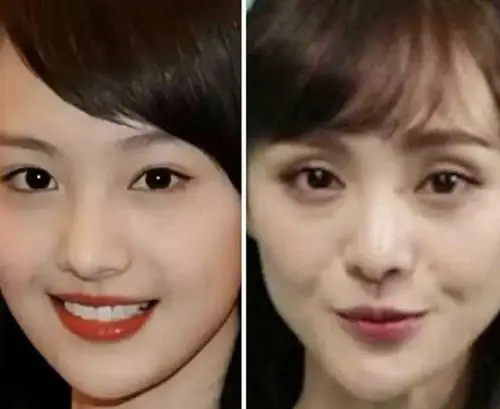 单眼皮有必要弄成双眼皮吗