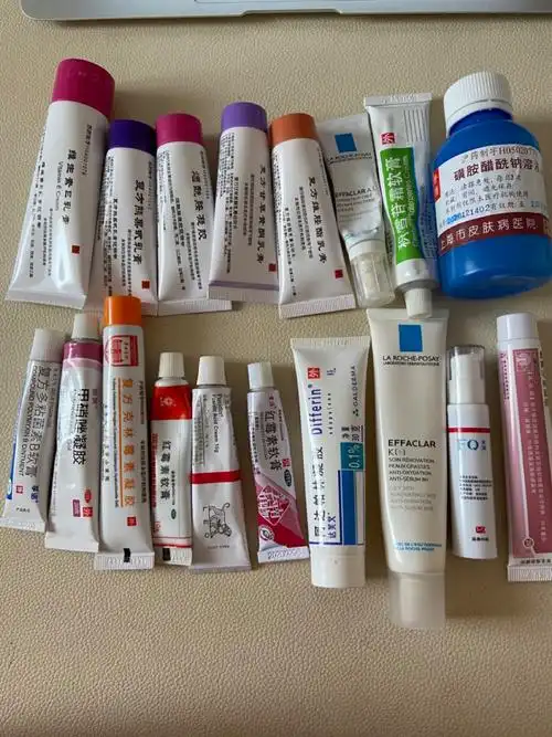 南京皮炎所看痘痘药膏一下子开多了91