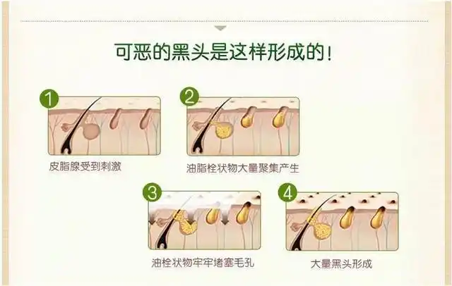 有效去黑头的方法