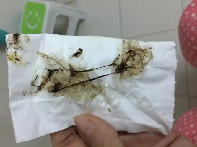 有可能是因为有妇科疾病的感染或者排卵期的出血导致的如果褐色的分泌