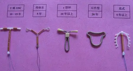 避孕环的种类有哪些,避孕环哪种好