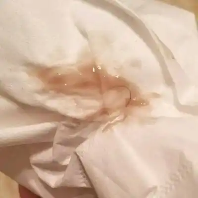 问答 怀孕期 匿名提问孕15周2017-01-23 推荐回答