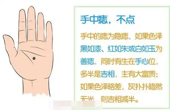 手掌心有痣图解,手掌心有痣这种手相的人-相术-荣耀易学