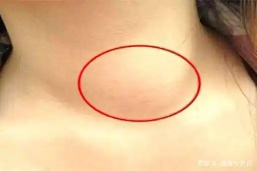 身体有病,淋巴结先知!这6处淋巴结决定了你90%的疾病,保护好它