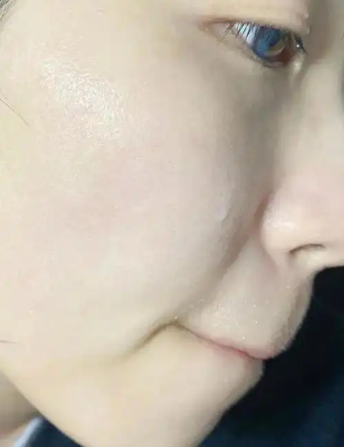 想要皮肤好敷面膜前记住多做这3步皮肤更水嫩光滑