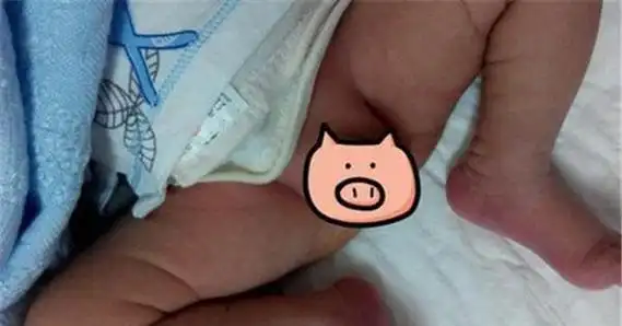 当妈妈们听到孩子不住啼哭的时候,一定要先检查孩子身体的某些部位,如