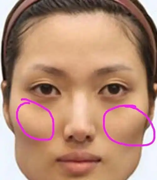 面相颧骨脸上高的女人_脸上颧骨高的面相_脸上的颧骨高面相