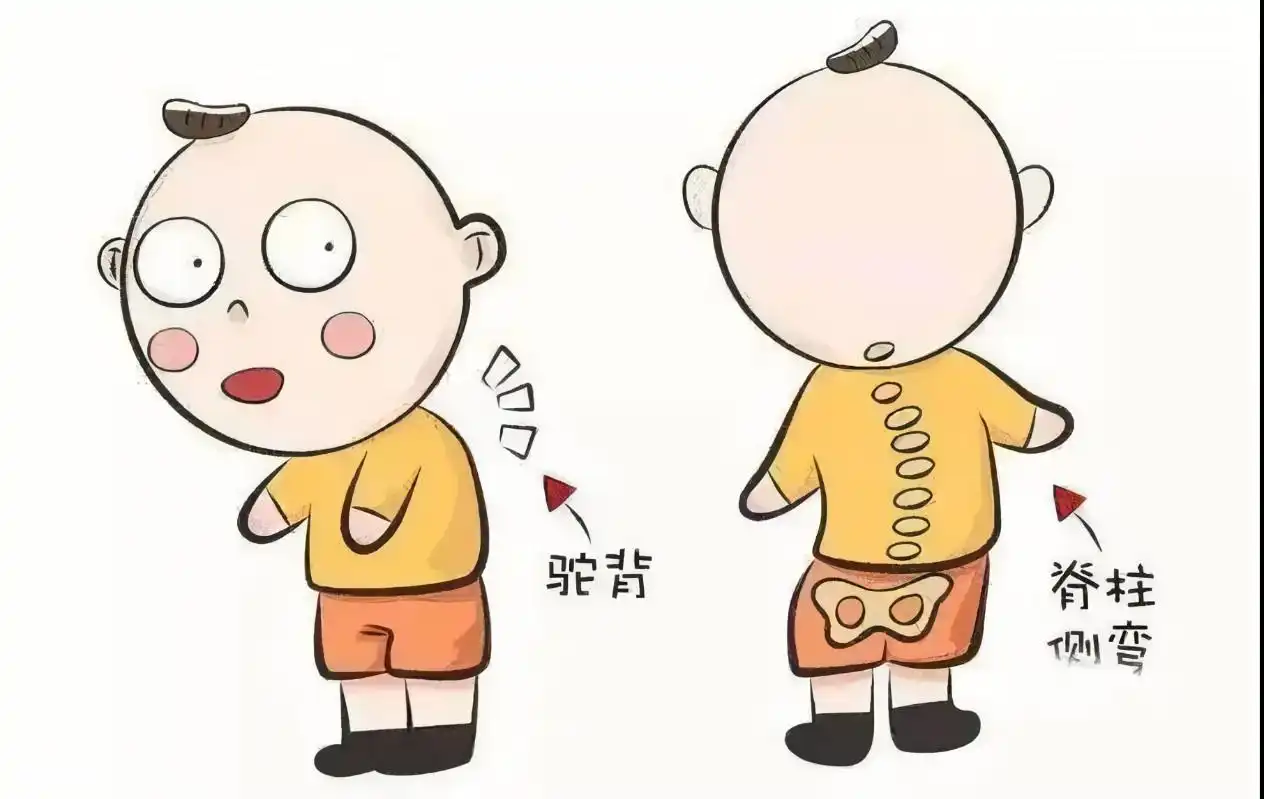 原创脊柱侧弯儿童青少年的又一健康杀手该如何预防