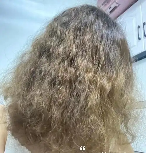 头发烫焦又舍不得剪有什么办法可以恢复或者补救一下