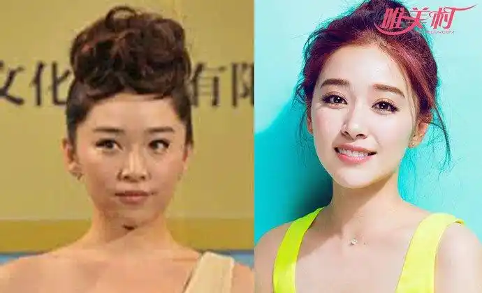 阚清子整容前后对比照 靠实力吃饭的女明星