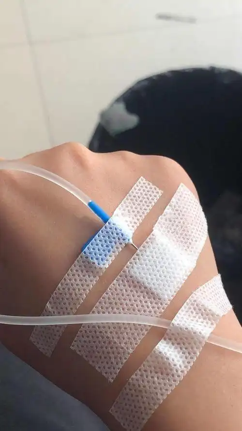 有吊水的照片不