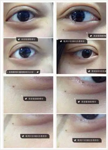 女生,混合性皮肤,年龄27岁,想用一款适合我的眼霜,推荐一下咯!