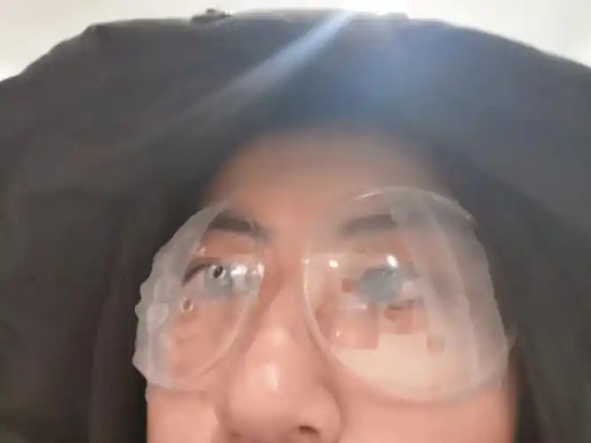 高度近视一千多度终于摘掉了眼镜
